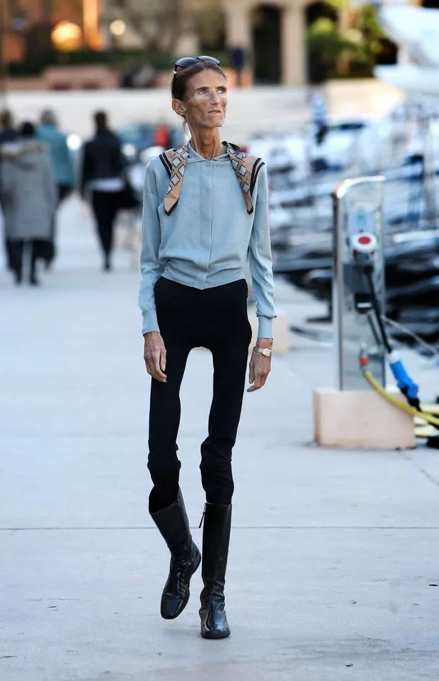 Valeria Levitin skinniest person